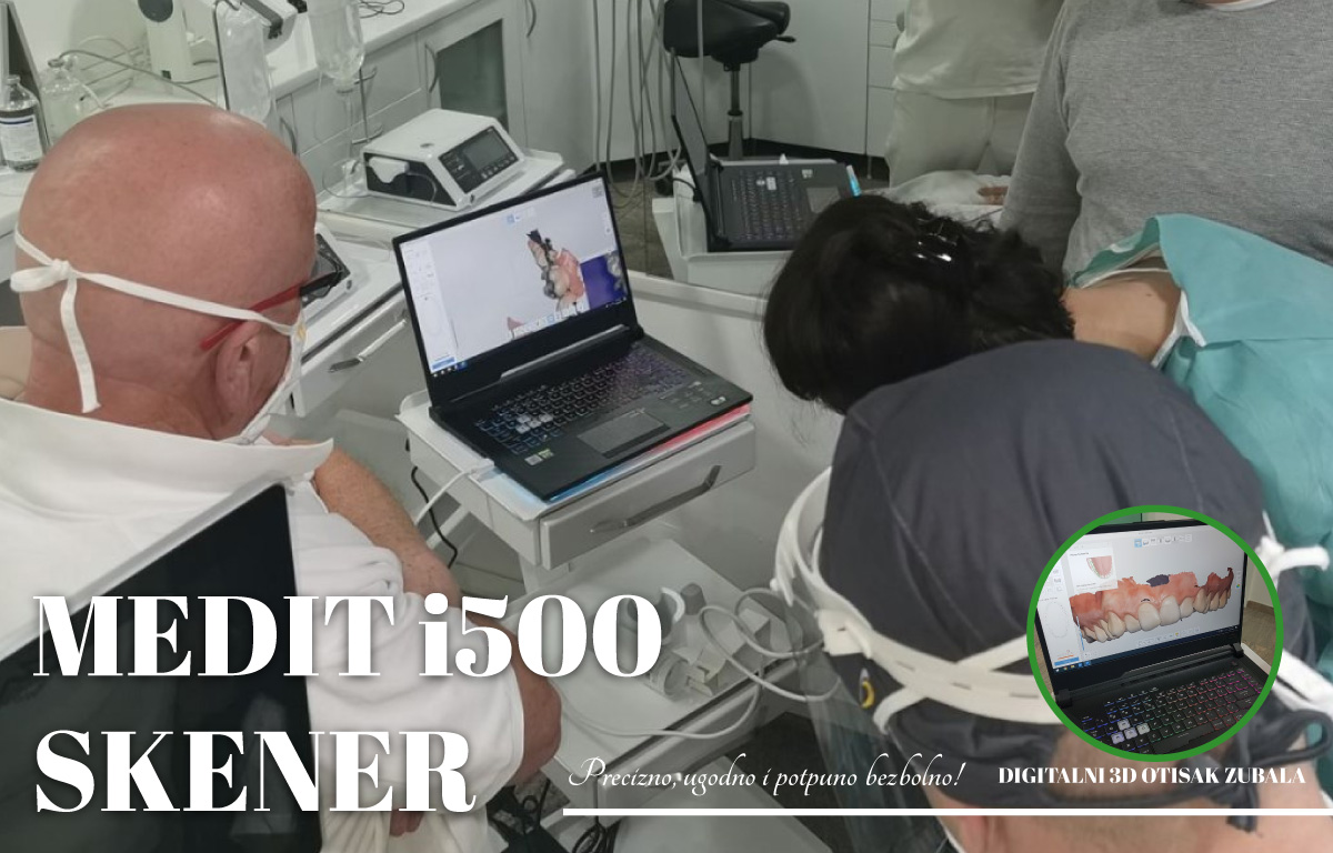 Savremeni intraoralni digitalni 3D skener za snimanje zuba i čeljusti